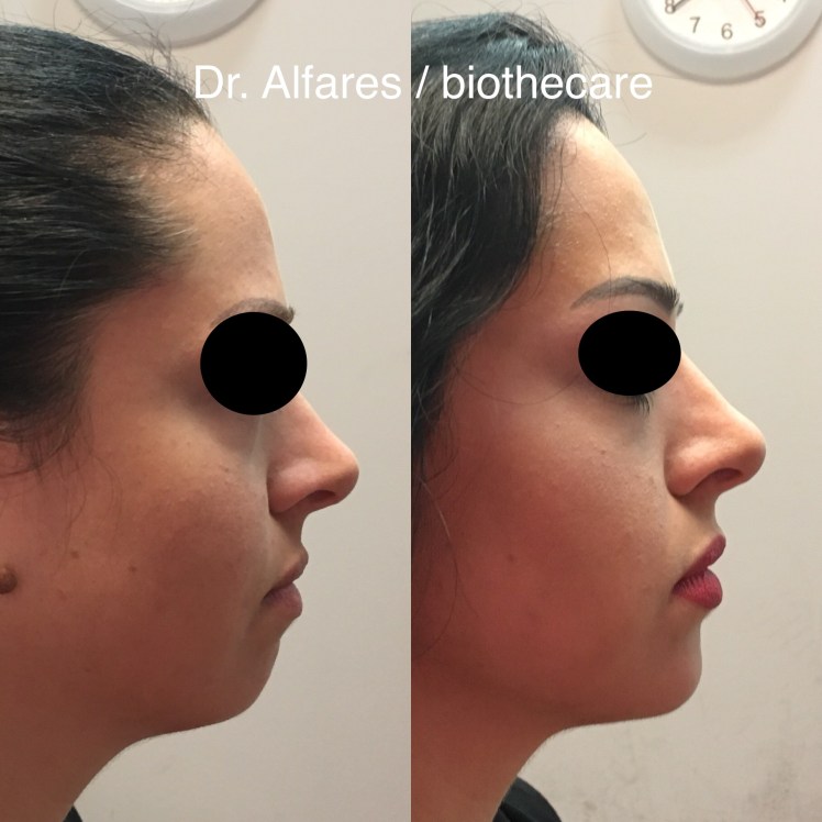 F9739FE1-69DA-4FB1-91D5-B33CB540D254